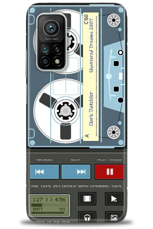 Xiaomi Mi 10T Kılıf HD Baskılı Kılıf - Nostaljik Kaset