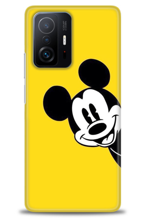 Xiaomi Mi 11T Pro Kılıf HD Baskılı Kılıf - Sarı Mickey Mouse