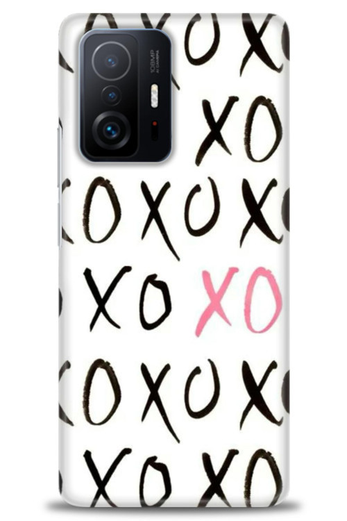 Xiaomi Mi 11T Pro Kılıf HD Baskılı Kılıf - XOXO