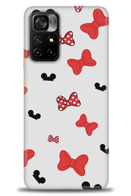 Xiaomi Redmi Note 11 Pro Plus Kılıf HD Baskılı Kılıf - Fiyonklar