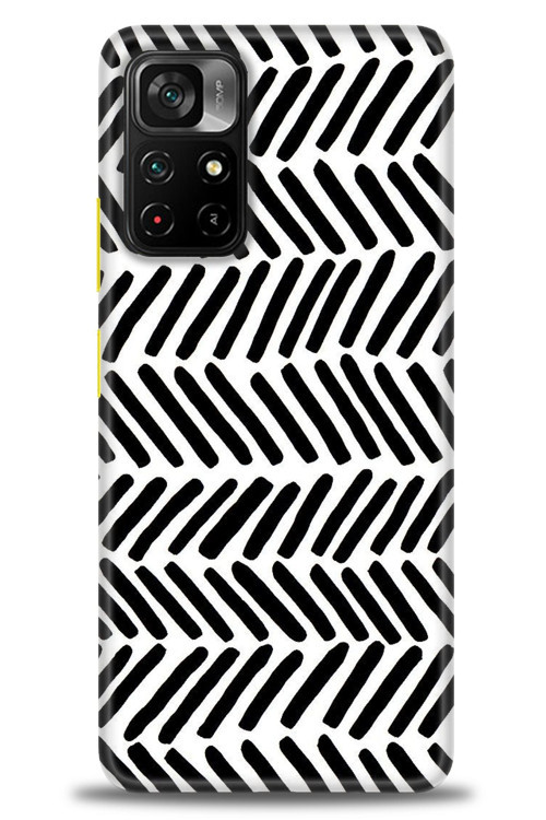 Xiaomi Redmi Note 11 Pro Plus Kılıf HD Baskılı Kılıf - Siyah Çubuklar