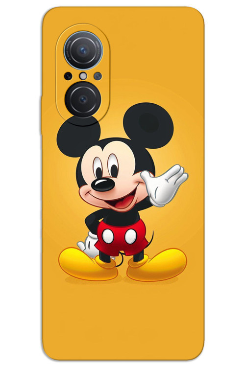 Huawei Nova 9 SE Kılıf HD Desen Baskılı Arka Kapak - Mickey 3