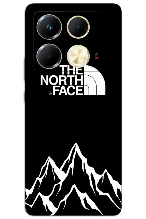 İnfinix Note 40 4G Kılıf HD Desen Baskılı Arka Kapak - The North