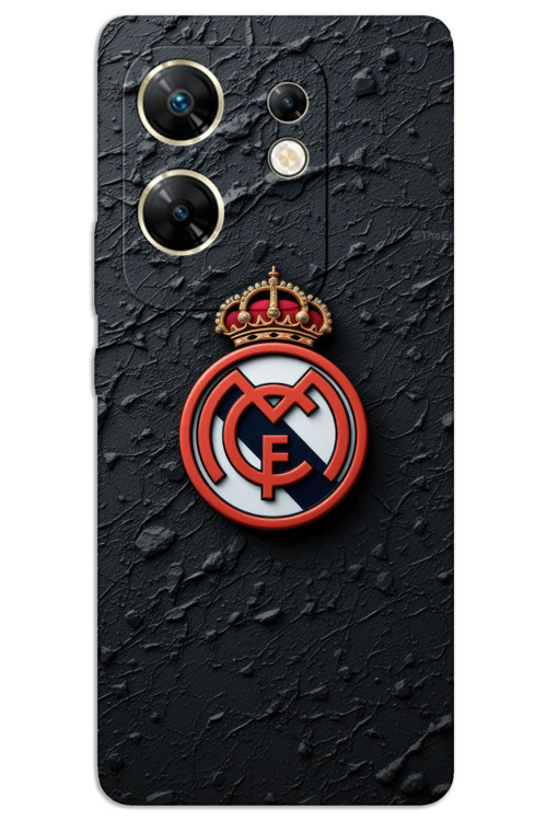 İnfinix Zero 30 4G Kılıf HD Desen Baskılı Arka Kapak - Real