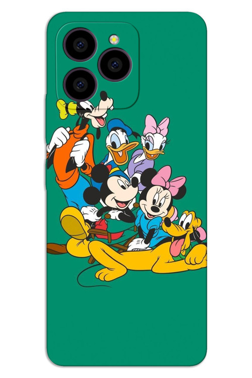 Omix X7 Kılıf HD Desen Baskılı Arka Kapak - Mickey 1