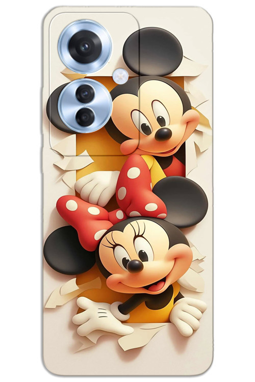 Oppo Reno 11F Kılıf HD Desen Baskılı Arka Kapak - Mickey 2