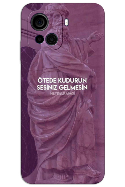Casper Via F30 Kılıf HD Desen Baskılı Arka Kapak - Ötede Kudurun