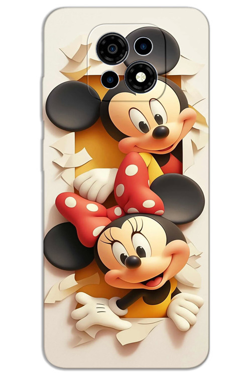 Casper Via M35 Kılıf HD Desen Baskılı Arka Kapak - Mickey 2