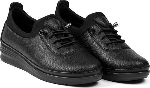 Kadın Siyah Ortopedik Desenli Anne Ayakkabısı - Rahat Kaymaz Taban, Bağcıklı Günlük Yürüyüş Ayakkabısı