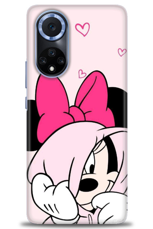 Huawei Nova 9 Kılıf HD Baskılı Kılıf - Pink