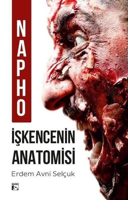Napho - İşkencenin Anatomisi