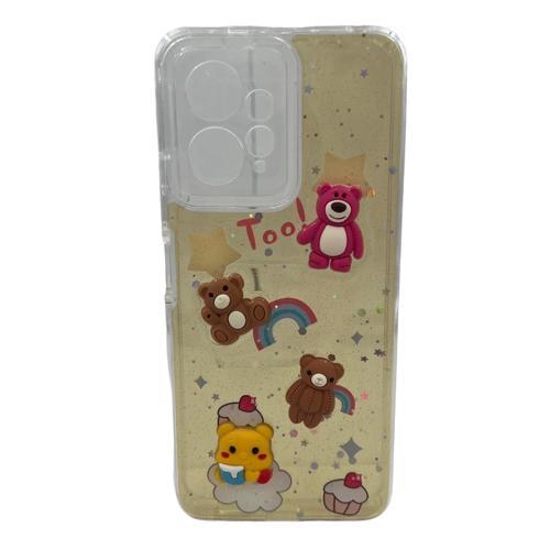 Xiaomi Redmi Note 12 Uyumlu Mimi Seri Arka Koruma Kılıf NT-107611