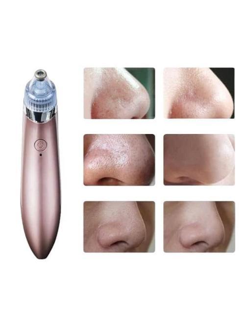 SİYAH NOKTA CİHAZI