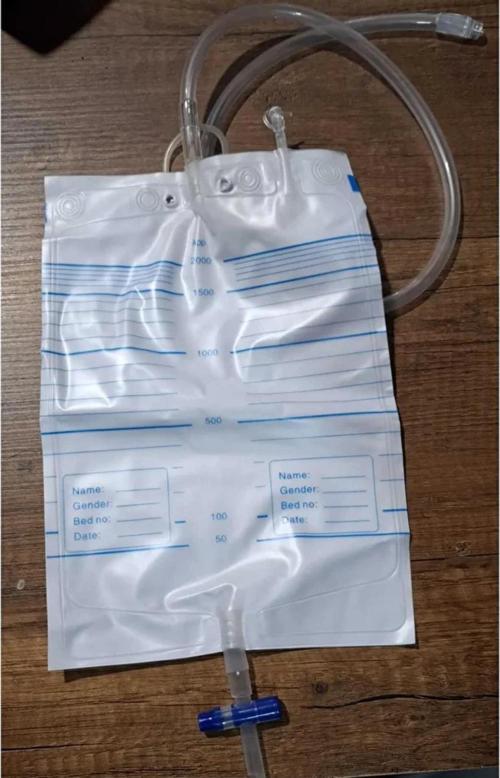 Nefrostomi Drenaj Torbası T-Valve 2000 Ml