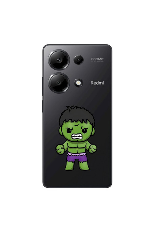 Xiaomi Redmi Note 13 Pro Uyumlu Şeffaf Kılıf Chibi 3 Tasarımlı