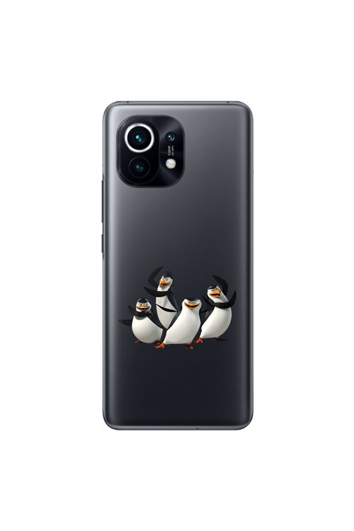Xiaomi Mi 11 Uyumlu Şeffaf Kılıf Cartoon 8 Tasarımlı