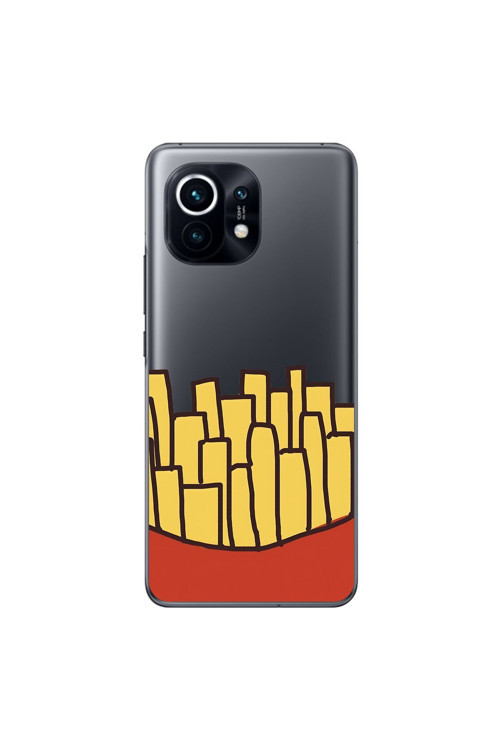 Xiaomi Mi 11 Uyumlu Şeffaf Kılıf Fast Food 5 Tasarımlı