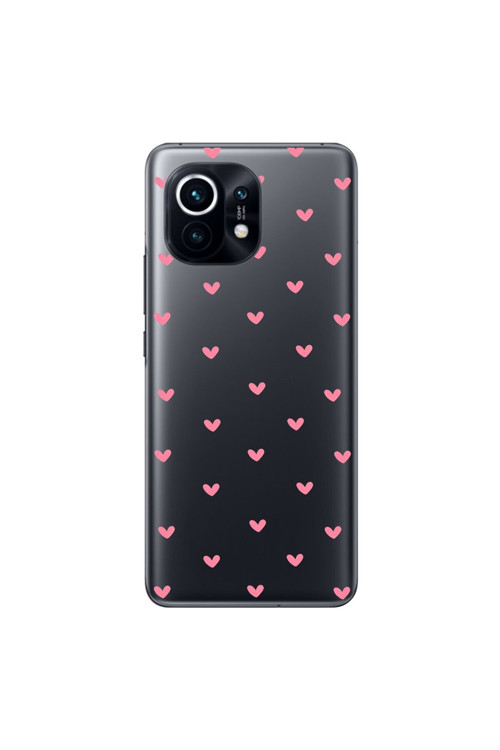 Xiaomi Mi 11 Uyumlu Şeffaf Kılıf Şeffaf Kalp 1 Tasarımlı