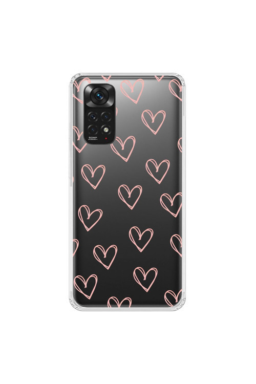 Xiaomi Redmi Note 11 Uyumlu Şeffaf Kılıf Şeffaf Kalp 2 Tasarımlı