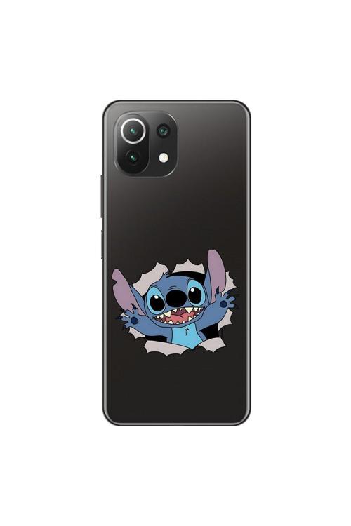Xiaomi Mi 11 Lite Uyumlu Şeffaf Kılıf Couple Stitch 1 Tasarımlı