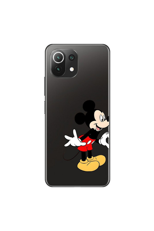 Xiaomi Mi 11 Lite Uyumlu Şeffaf Kılıf Couple Mickey 1 Tasarımlı