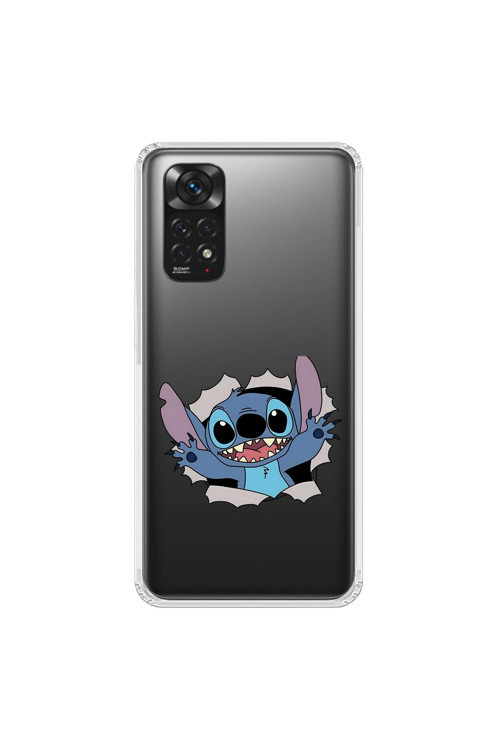Xiaomi Redmi Note 11 Uyumlu Şeffaf Kılıf Couple Stitch 1 Tasarımlı