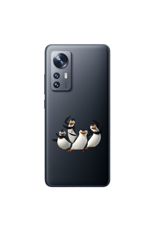Xiaomi Mi 12 Uyumlu Şeffaf Kılıf Cartoon 8 Tasarımlı
