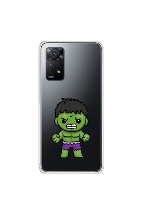 Xiaomi Redmi Note 11 Pro Uyumlu Şeffaf Kılıf Chibi 3 Tasarımlı
