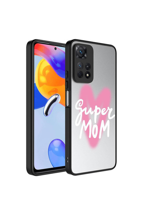 Xiaomi Redmi Note 11 Pro 5G Kılıf Aynalı Desenli Kamera Korumalı Parlak Mirror Kapak