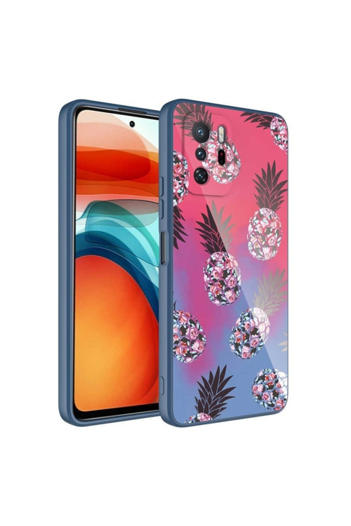 Xiaomi Redmi Note 10 Pro Kılıf Kamera Korumalı Desenli Sert Silikon Epoksi Kapak