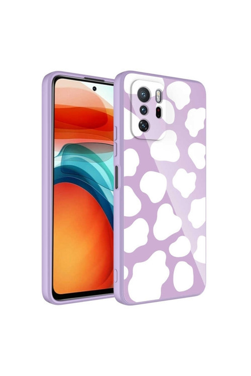Xiaomi Redmi Note 10 Pro Kılıf Kamera Korumalı Desenli Sert Silikon Epoksi Kapak