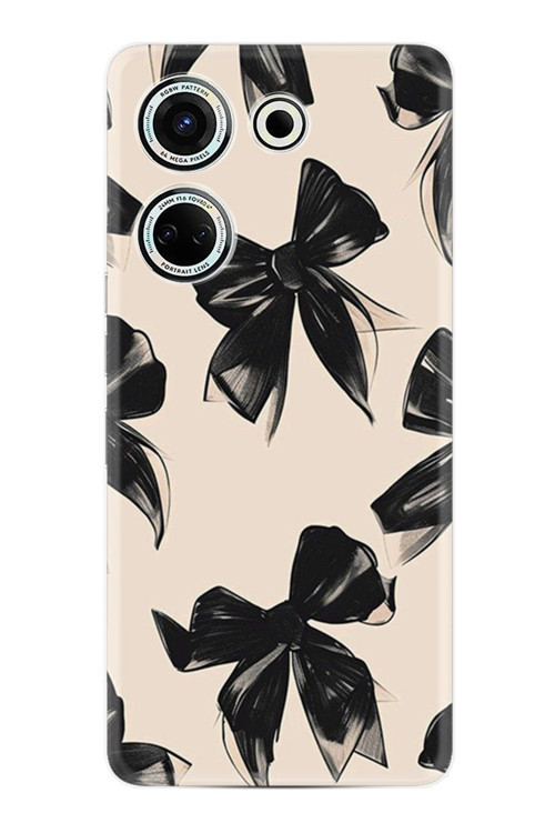 Camon 20 Kılıf Baskılı Xz-07-16 Desenli Cmtcno-79.Jpg
