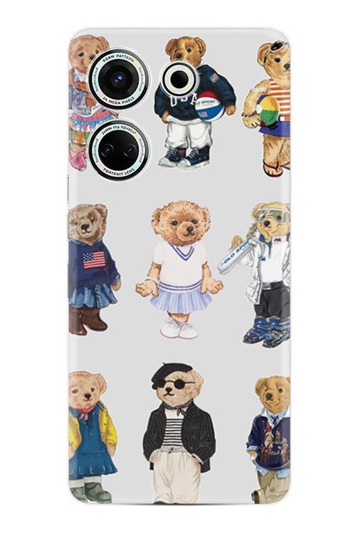 Camon 20 Kılıf Baskılı Xz-07-16 Desenli Cmtcno-91.Jpg