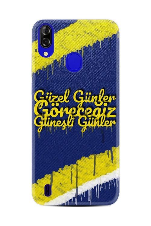 P13 Blue Kılıf Hd Desenli Baskılı Xt-Blue Stk-532.Jpg