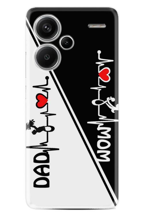 Redmi Note 13 Pro Plus 5G Kılıf Baskılı X31-1Xgt Proplus70.Jpg