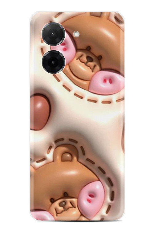 Redmi A5 Kılıf Yüksek Korumalı Baskılı Desenli Kapak Stk-529.Jpg