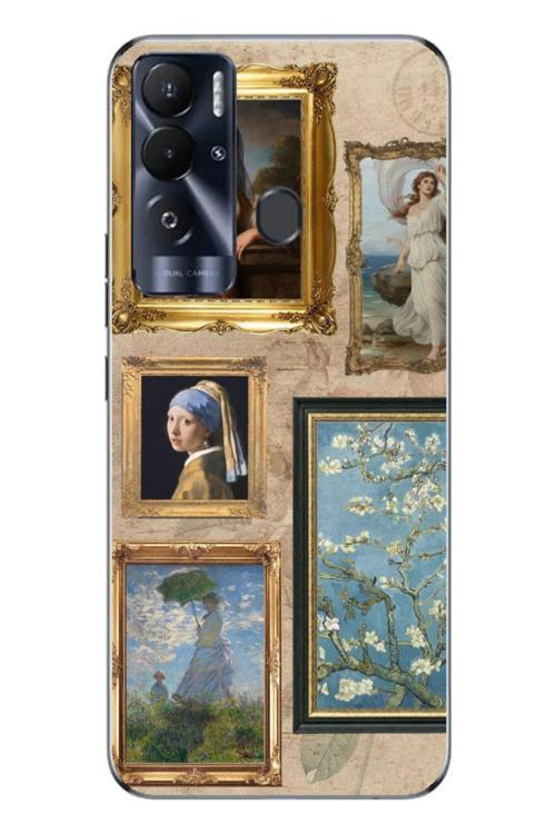 Pova Neo Kamera Korumalı Baskılı Desenli Özel Seri Kılıf Kapak