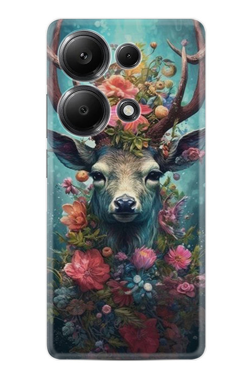 Redmi Note 13 Pro 5G Kılıf Hd Desenli Baskılı Happy Seri Kapak Xt-Ren13Pro Stk-65.Jpg