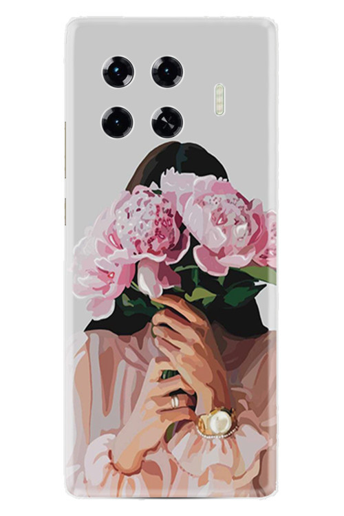 Spark 20 Pro Plus Kılıf Hd Baskılı Kılıf Yüksek Korumalı - Name-304.Tecno