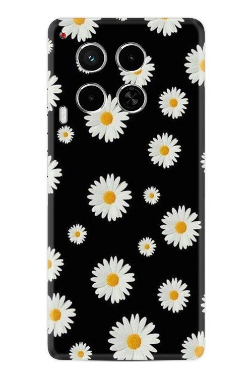 Camon 30 Kılıf Kapak Hd Desenli Milenyum Seri Xt-Camon304G-374-Camon30