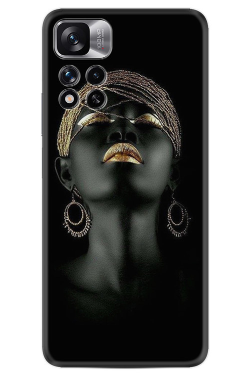 Xiaomiredmi Note 11 Pro Kılıf Hd Baskılı Desenli Happy Seri Xt-Rn Stk-204-Redminote11Pro