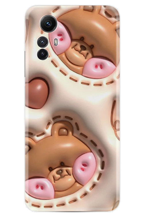 Redmi Note 12S Kılıf Özel Seri Baskılı Desenli Yüksek Korumalı Xt-529.Jpg