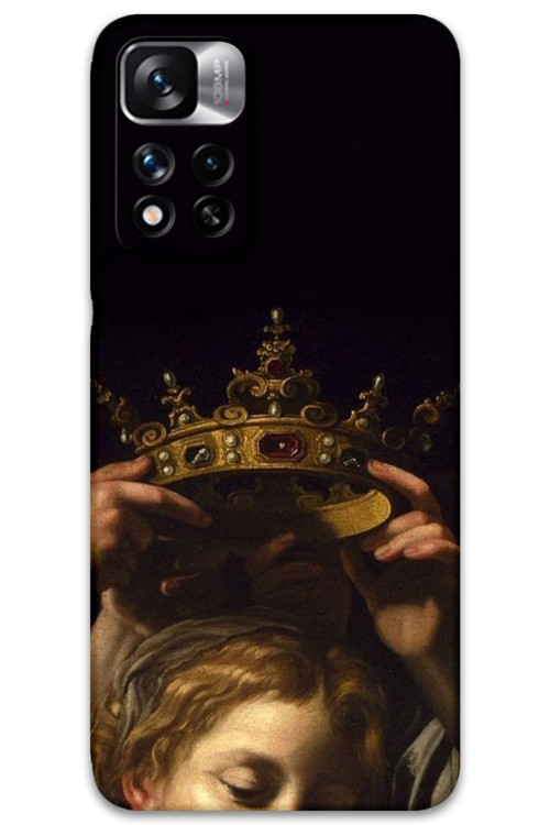 Poco M4 Pro 5G Uyumlu Retro Desenli Telefon Kılıfı + Ekran Koruyucu - 5833