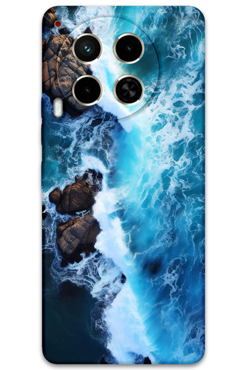 Tecno Camon 30 Uyumlu Mermer Desenli Telefon Kılıfı + Ekran Koruyucu - 5810
