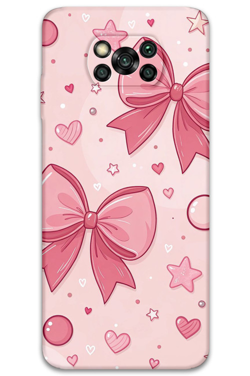 Poco X3 Pro Uyumlu Kurdele Desenli Telefon Kılıfı + Ekran Koruyucu - 5803