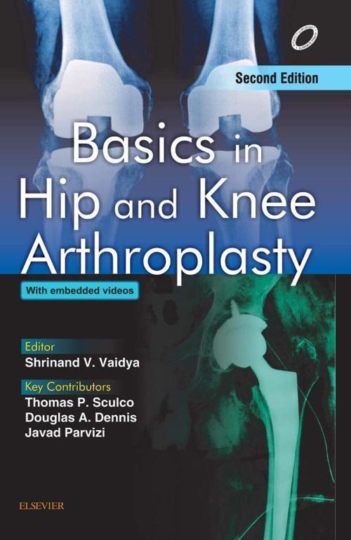 Basics in Hip and Knee Arthroplasty 2nd Edition