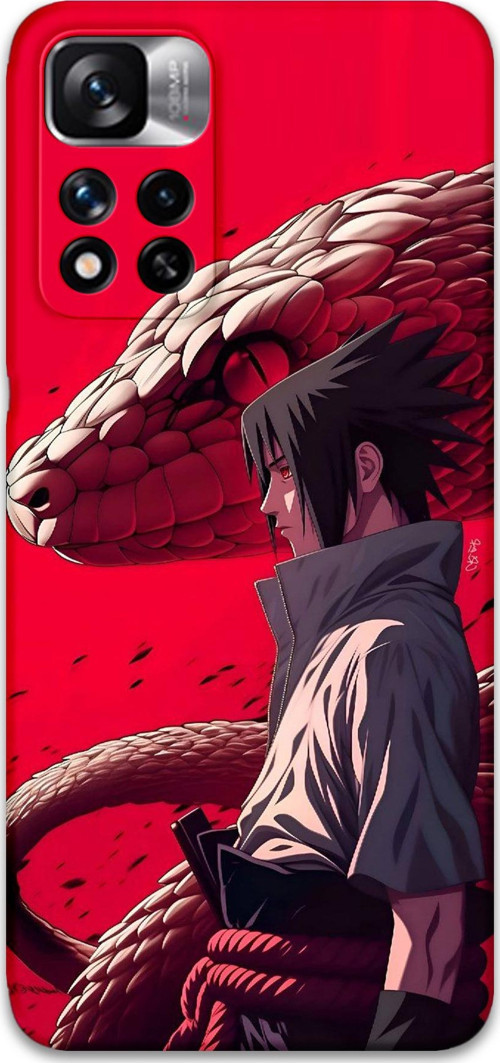 Xiaomi Redmi Note 11 Pro Plus 5G Uyumlu Anime Desenli Telefon Kılıfı + Ekran Koruyucu - 5746
