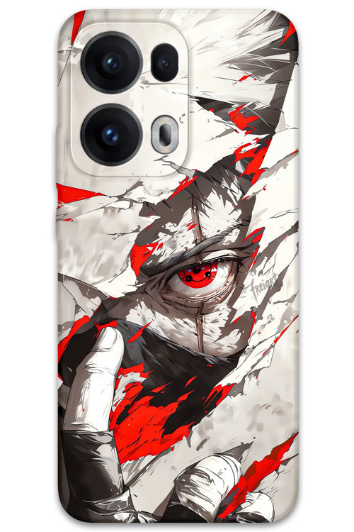 Oppo Reno 13 Pro 5G Uyumlu Anime Desenli Telefon Kılıfı + Ekran Koruyucu - 5876