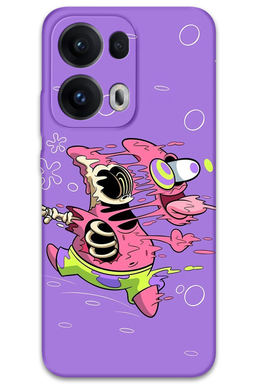 Oppo Reno 13 Pro 5G Uyumlu Sünger Bob Desenli Telefon Kılıfı + Ekran Koruyucu - 5939