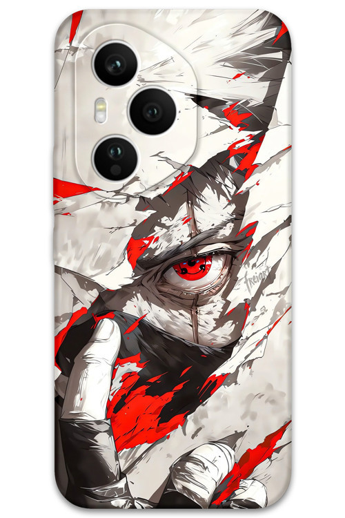 Honor 400 Pro Uyumlu Anime Desenli Telefon Kılıfı + Ekran Koruyucu - 5876